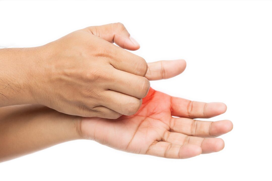 Niežėjimas grybeliu ir jo apdorojimas demyxil kremu